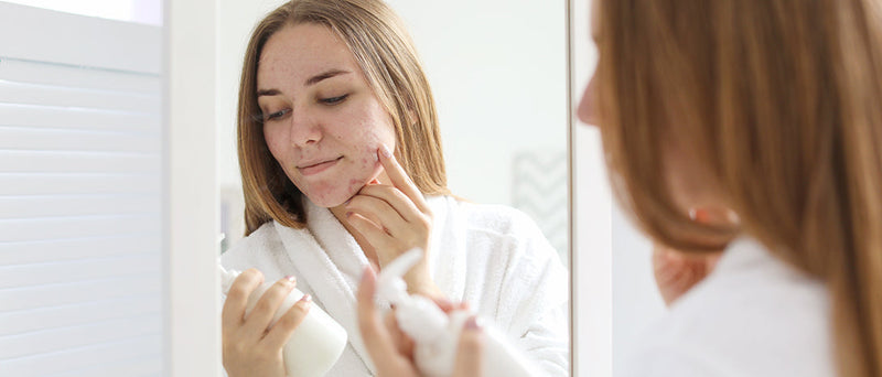 Peaulette sélectionne des soins naturels et adaptés aux peaux sensibles sujettes aux imperfections. Un sérum anti imperfections bio ou naturel permettra de ne pas agresser votre peau déjà fragilisée. 